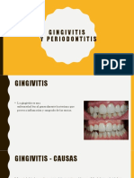 Gingivitis y Periodontitis