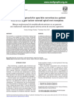 Myofunctional Approach For Open Bite Correction in A Patient With Severe Upper Incisor External Apical Root Resorption