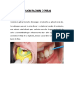 Fluorizacion Dental
