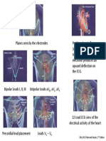 12 Lead ECG 3D View