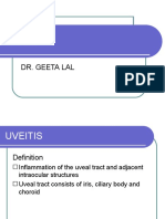 Uveitis