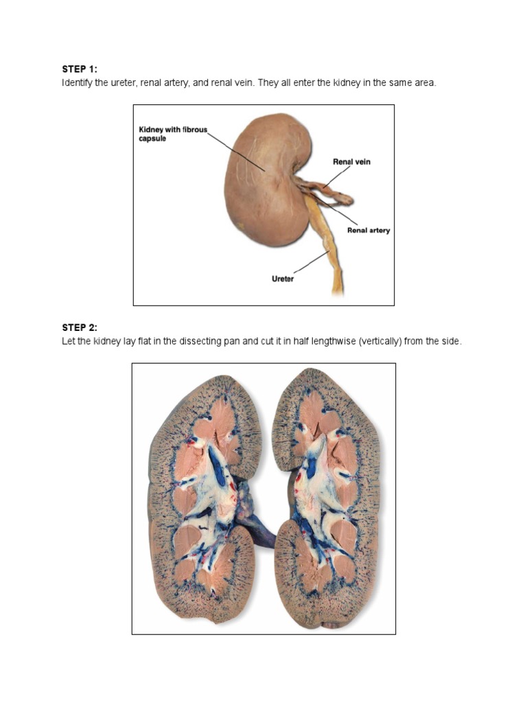 Kidney Dissection Guide PDF PDF