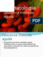 Leucemia Mieloide Aguda