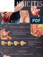 Apendicitis - Mentes Médicas