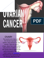 Ovarian Cancer