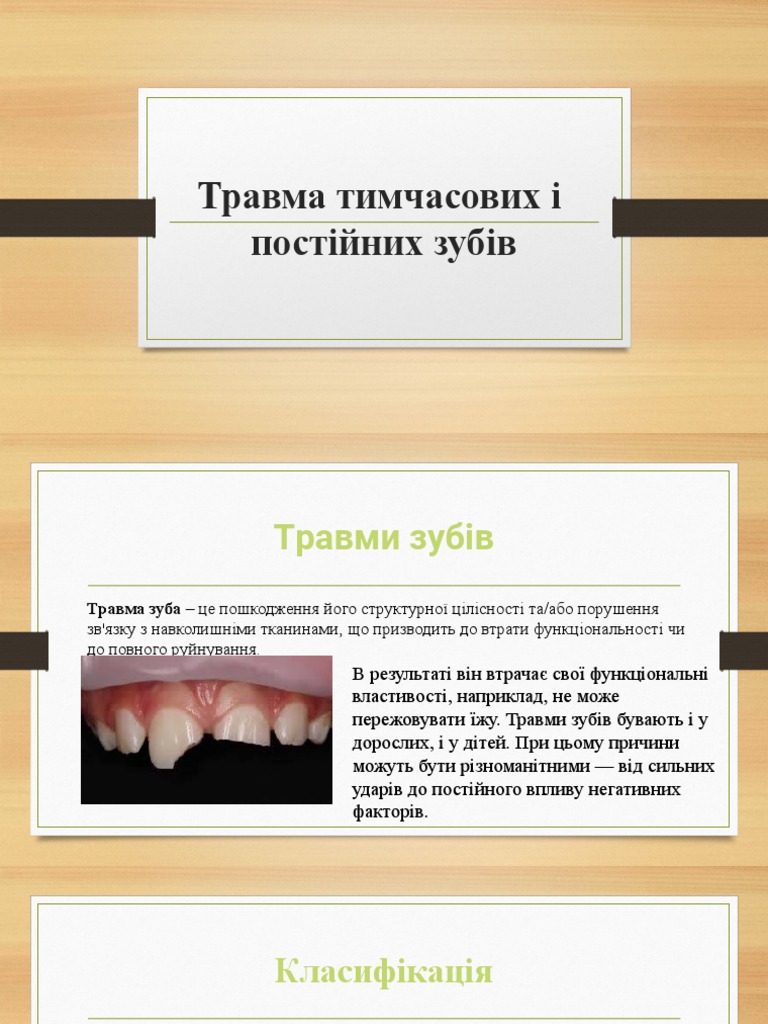 Травма зубів | PDF