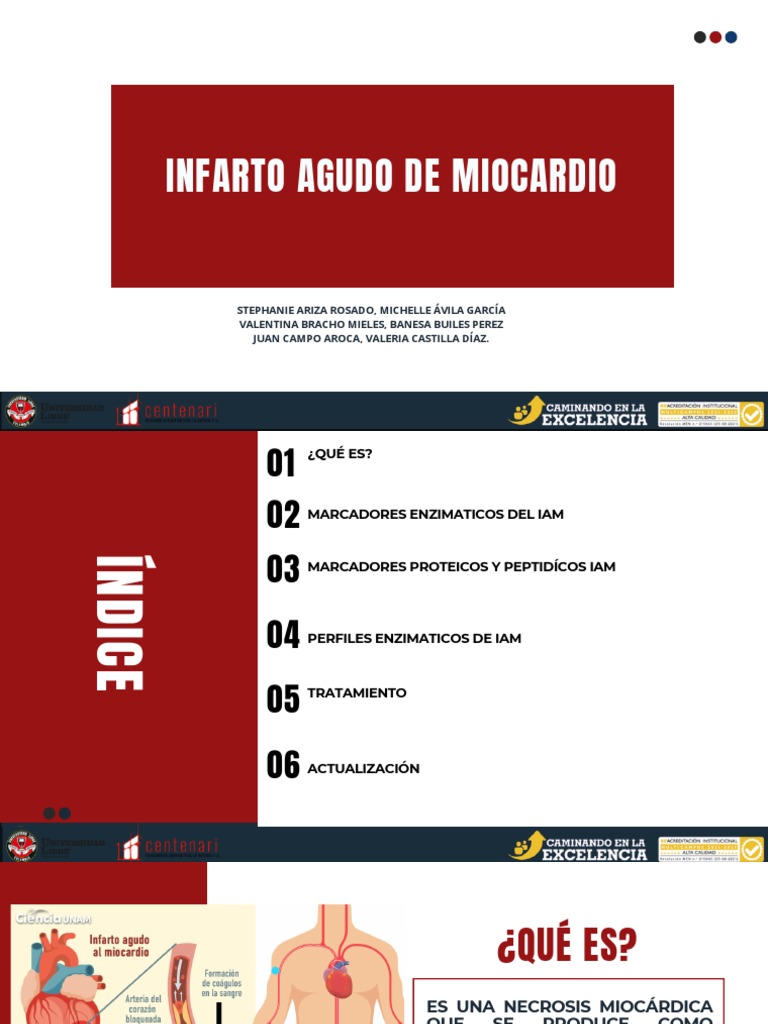 Infarto Agudo de Miocardio: Diagnóstico y Tratamiento | PDF | Aspirina ...