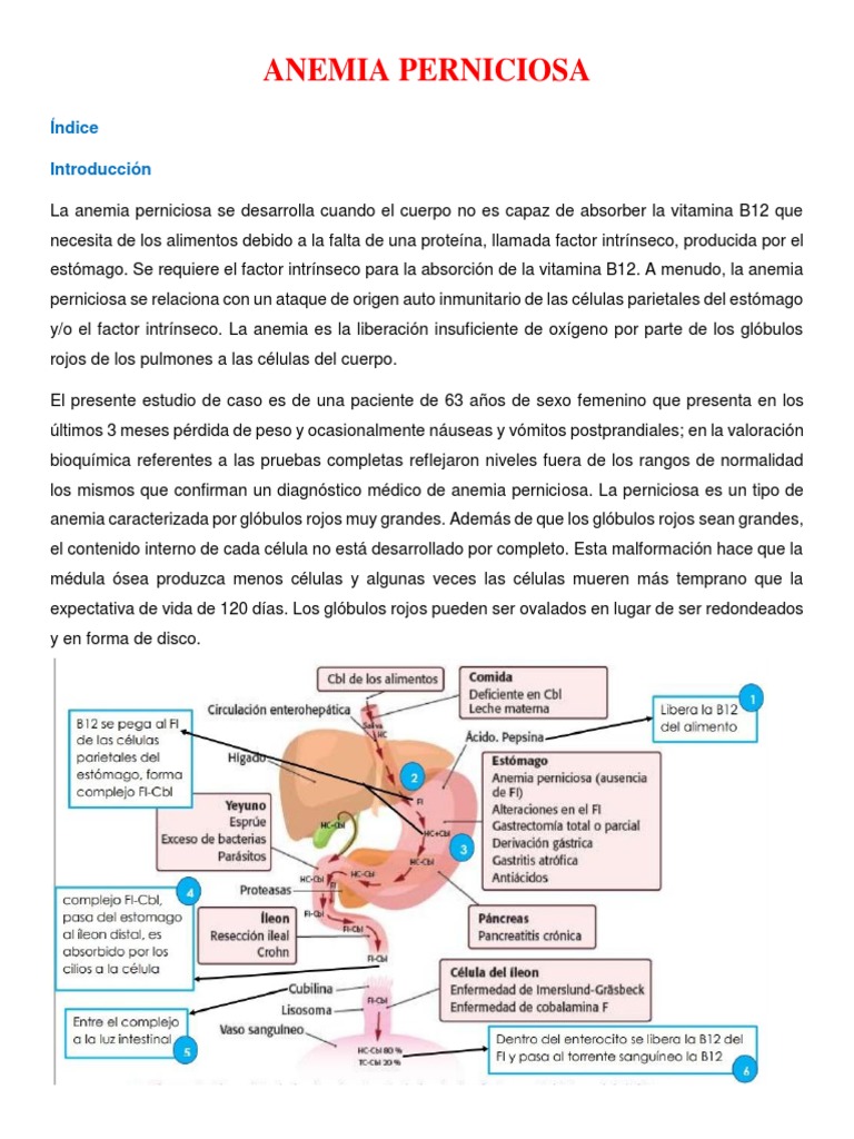 ANEMIA PERNICIOSA Sisisi PDF Vitamina B12 Glóbulo rojo