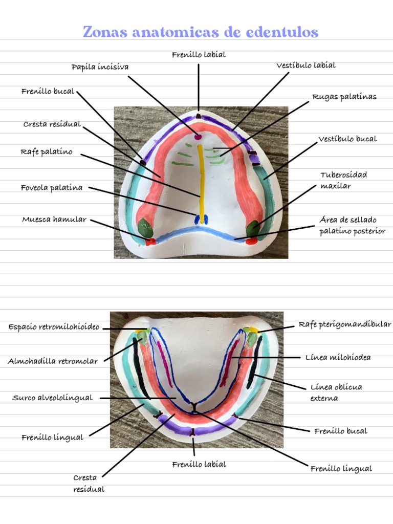 Zonas Anatómicas en Edéntulos | PDF