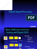 EEG Digital Processing
