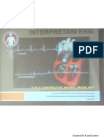 Interpretasi Ekg