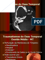 Traumatismos Do Temporal