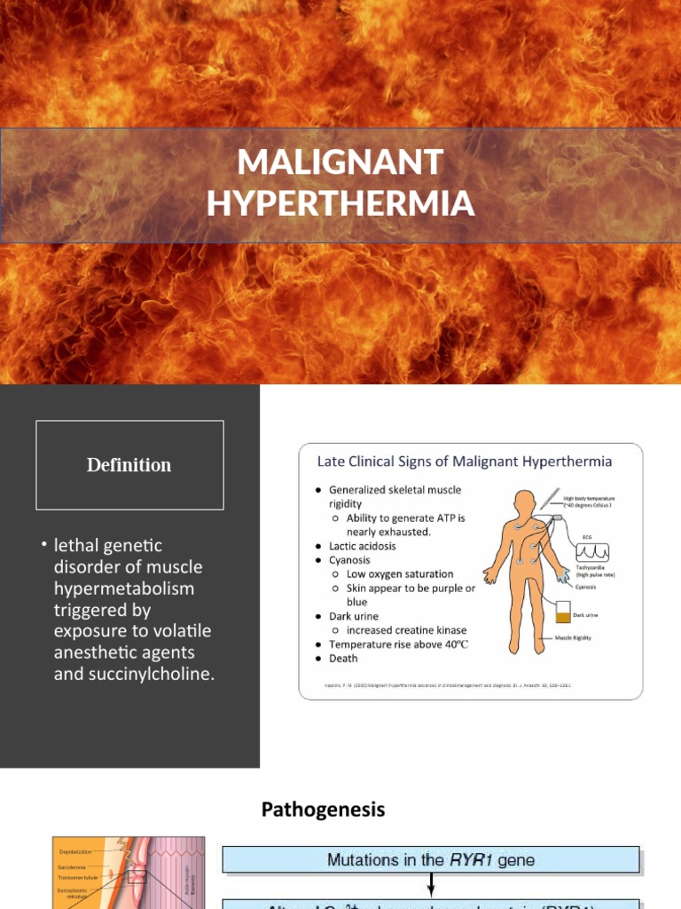 Malignant Hyperthermia PDF