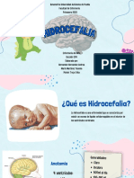 Hidrocefalia - Enfermería Del Niño