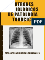 Patrones Radiologicos Torax
