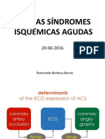 ECG Nas Síndromes Isquêmicas Agudas 20 06 2016 Emergência Final