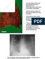 Patho Pulmonary With Notes