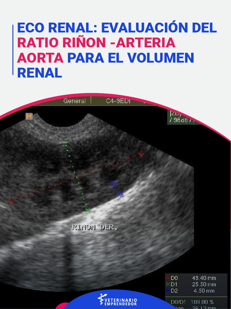 Evaluación Ecográfica de Hipoplasia Renal | PDF