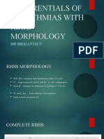 Differentials of Arrythmias With RBBB Morphology