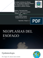 Neoplasias Del Esofago