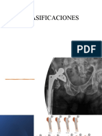 CLASIFICACIONES de Ortopedia y Tramatologia