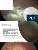 Commotio Retinae Edema de Berlin