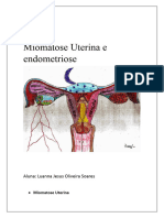 Miomatose Uterina e Endometriose