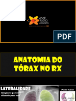 Mod 2 Etapa 1 Aula 1 - Anatomia Do Torax No Rx