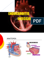 Endocarditis Infecciosa 2023