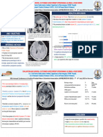 Gliomas Poster