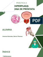 Hiperplasia Benigna de Próstata