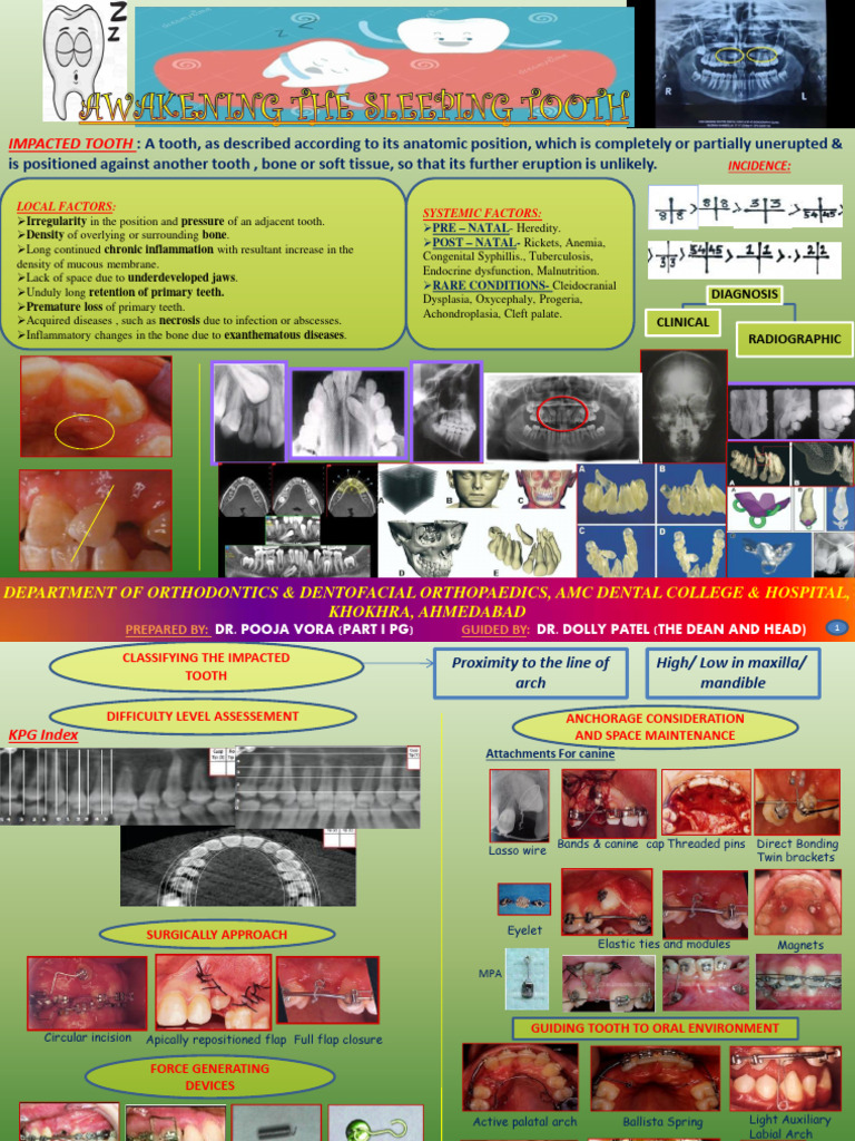 For Poster K9 Impaction | PDF | Tooth | Orthodontics