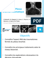 Imagerie Du Plexus Brachial Traumatique