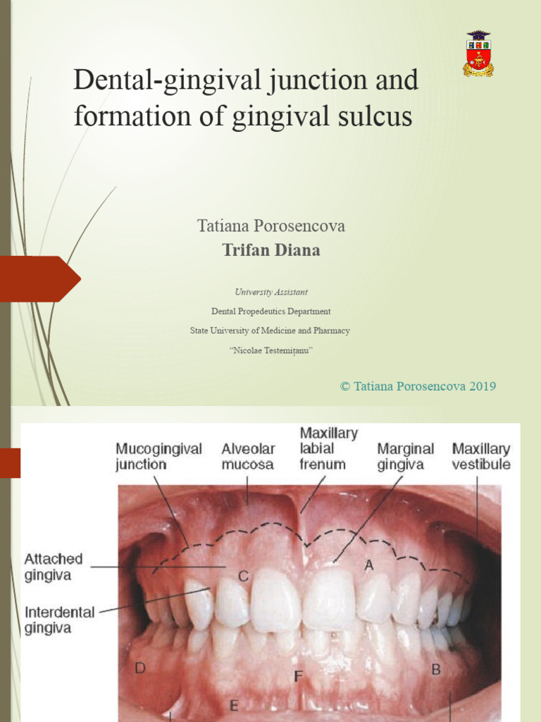 2__Tema_3_Dentalgingival_junction_and_formation_of_gingival_sulcus