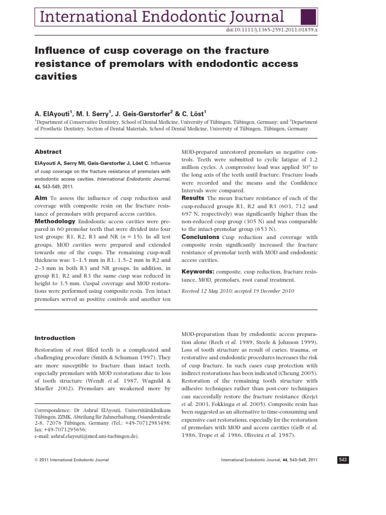 In Uence of Cusp Coverage On The Fracture Resistance of Premolars With