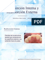 Reabsorcion Externa