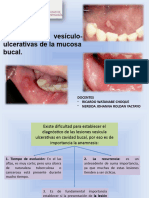 Lesiones Vesículo Ulcerativas de La Mucosa Bucal