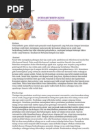 Download Rehabilitasi Medik Osteoarthritis by ansh_07_fk_unsri SN67096594 doc pdf