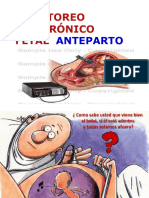 2.-Monitoreo Electrónico Fetal Ante Parto