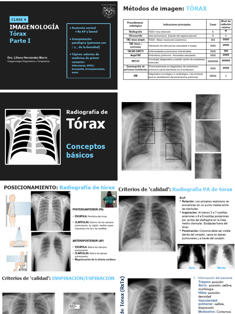 Tipos de Tórax y Patrón Reticular TAC | PDF | Pulmón | Aorta