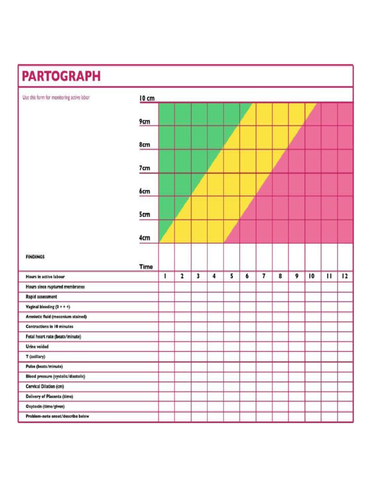 Partograph | PDF