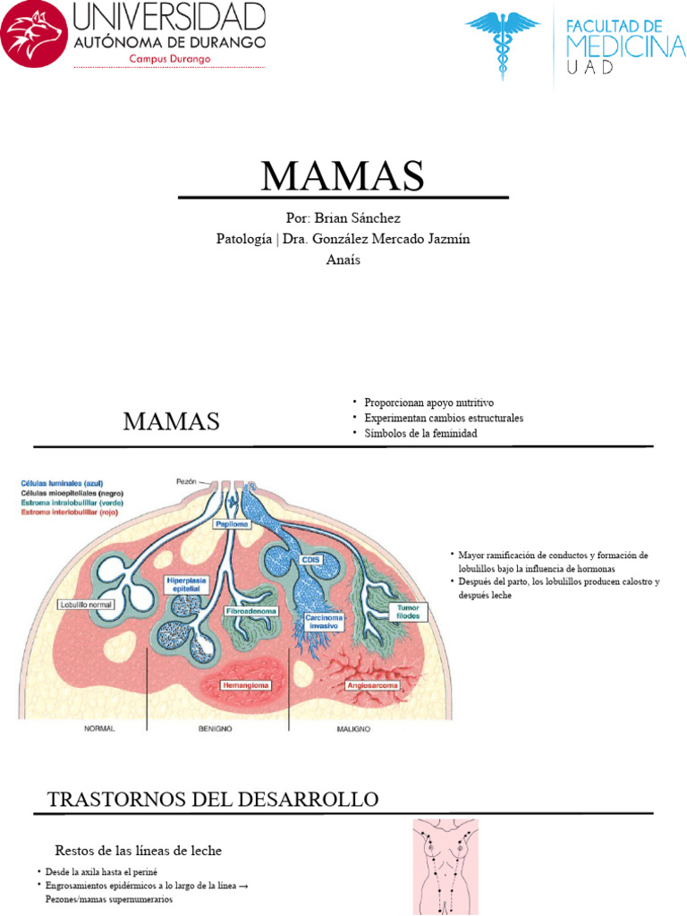 Mastopatía y trastornos mamarios | PDF | Pecho | Especialidades Medicas