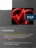 Arrhythmia 2