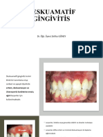 Desquamatif Gingivitis
