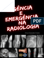 Urgência e Emergência Na Radiologia