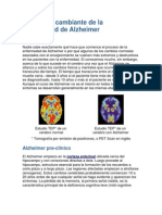 El Cerebro Cambiante de La Enfermedad de Alzheimer