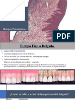 Biotipos Periodontales