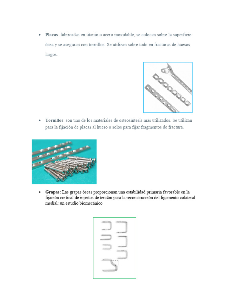 CLAVE 29 (Placas, Tornillos, Grapas) PDF
