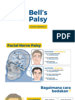 Bells Palsy NDNE