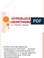Hyperlucent Hemithorax
